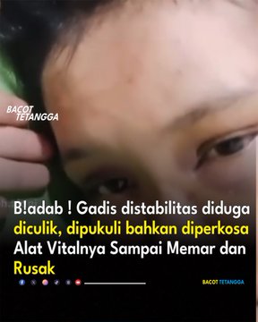 Badab Gadis Disabilitas Diduga Diculik Dipukuli Bahkan Diperkosa